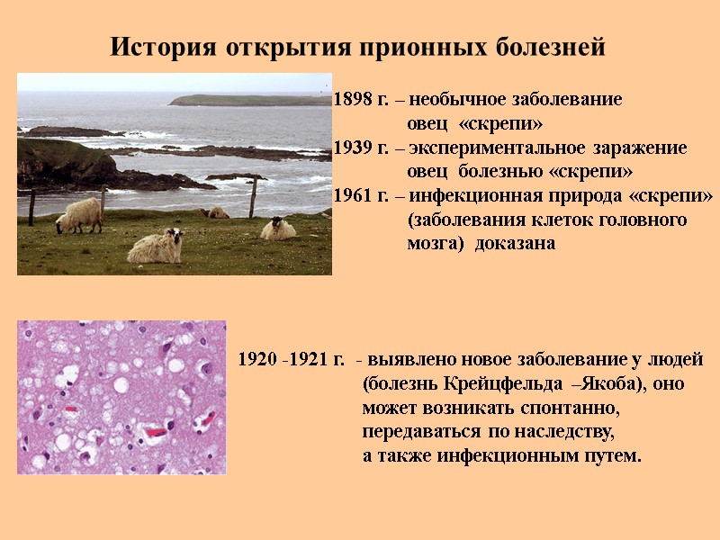 История открытия прионных болезней 1898 г. – необычное заболевание     